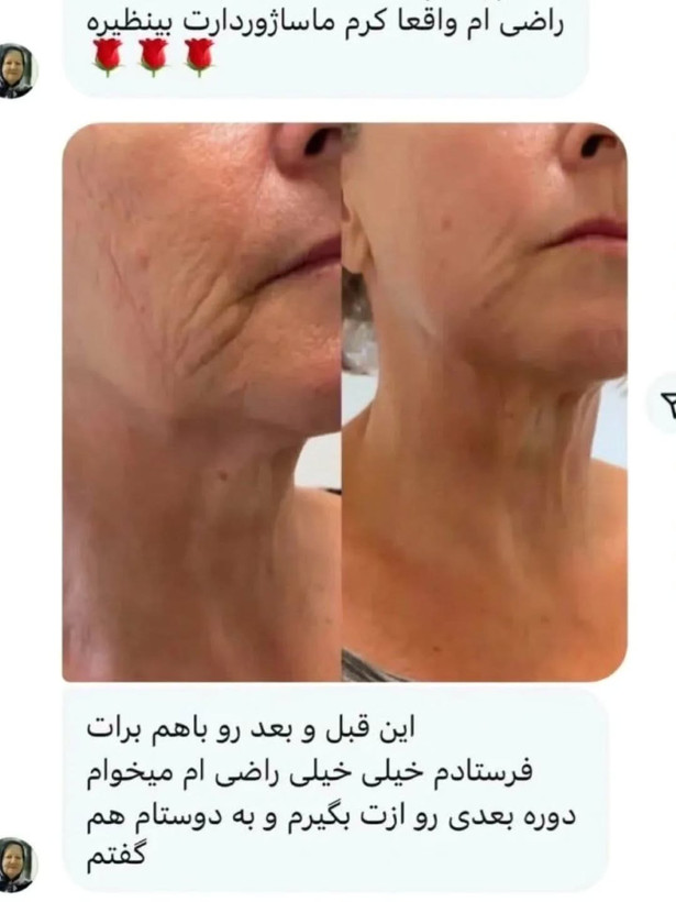 کرم غلتک دار دوازده کاره بیوممتیک لاکچری کوین فرانسوی