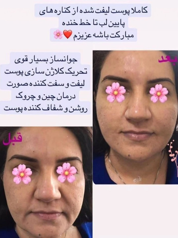 کرم غلتک دار دوازده کاره بیوممتیک لاکچری کوین فرانسوی