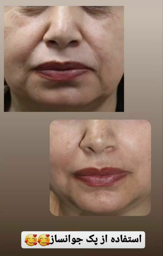 کرم بیوممتیک ضدچین وچروک پنجکاره گاتیو