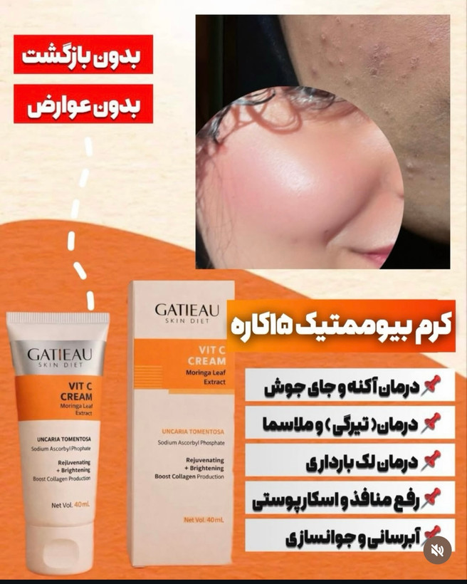 كرم بيوممتيك اصل گاتيو ضدلك قوي