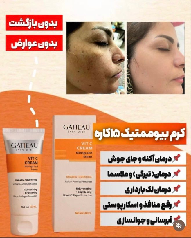 كرم بيوممتيك اصل گاتيو ضدلك قوي