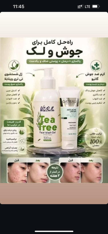كرم ضدجوش وضد آكنه بيوممتيك باپك كامل باضمانت