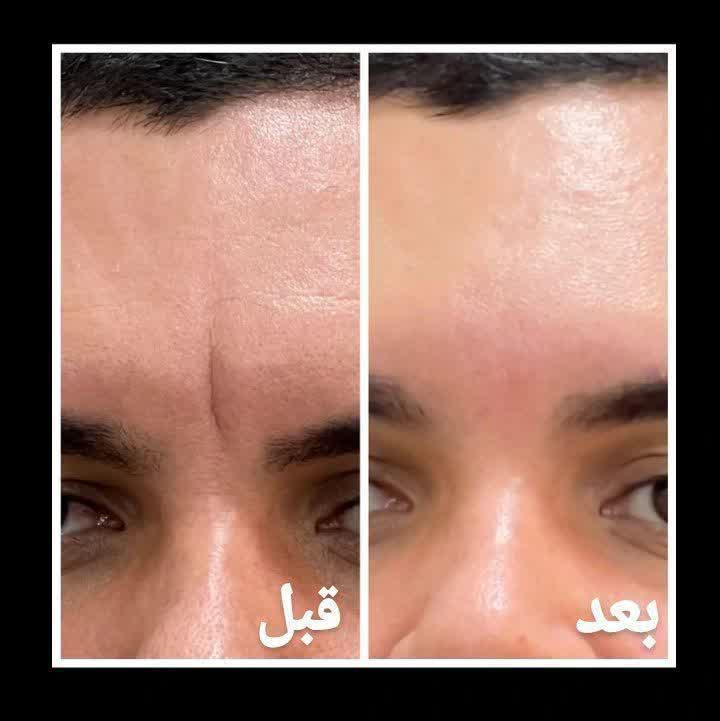 کرم غلتک دار دوازده کاره بیوممتیک لاکچری کوین