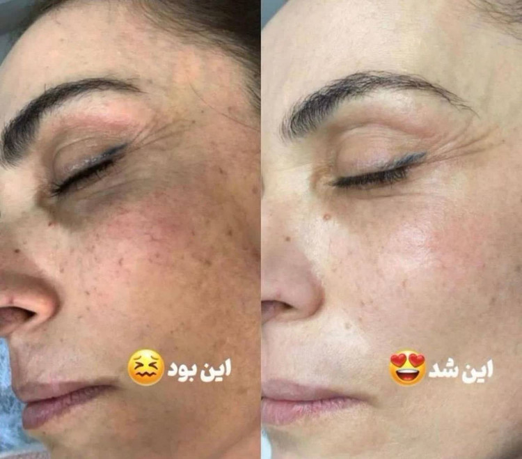 كرم بيوممتيك اصل گاتيو ضدلك قوي