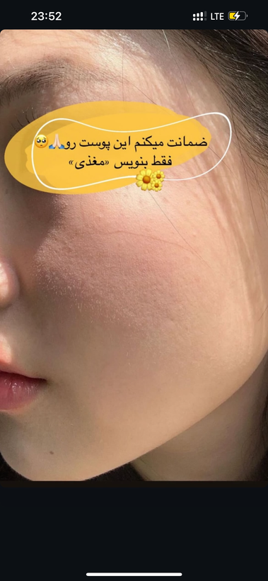 سرم مغذي همه كاره بيوممتيك لاكچري كوين فرانسه بمب هلويي صورت