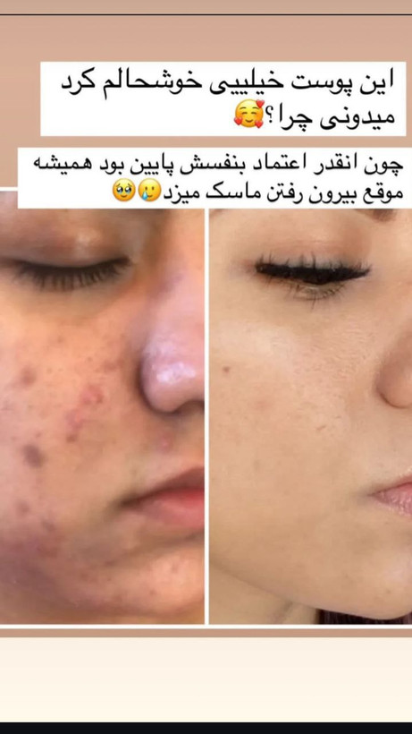سرم مغذی لاکچری کوین فرانسوی پانزده کاره روتین کامل معجزه پوست
