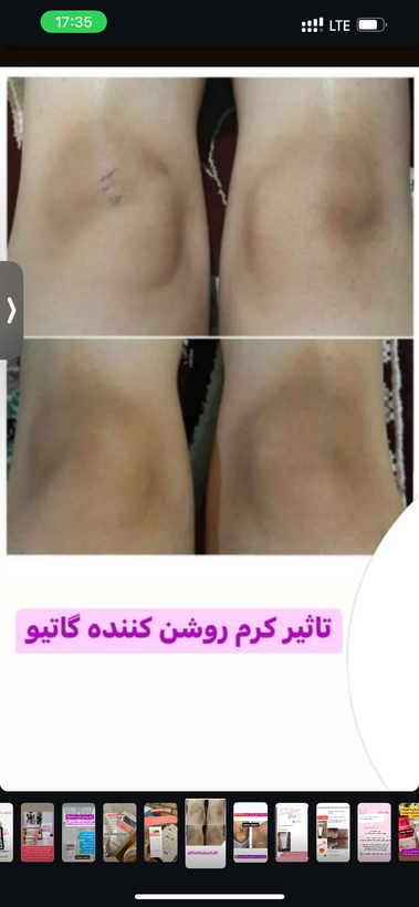 سفید کننده تیرگی های بدن اصلوباضمانت