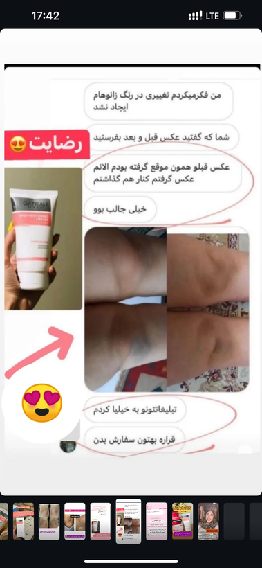 سفید کننده تیرگی های بدن اصلوباضمانت