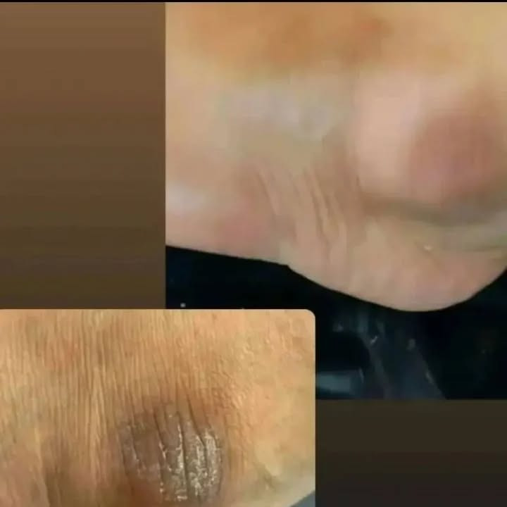 سفید کننده تیرگی های بدن اصلوباضمانت