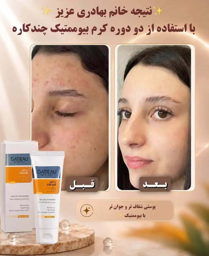 كرم ضدلك و روشن كننده بيوممتيك پوست هلويي وجذاب