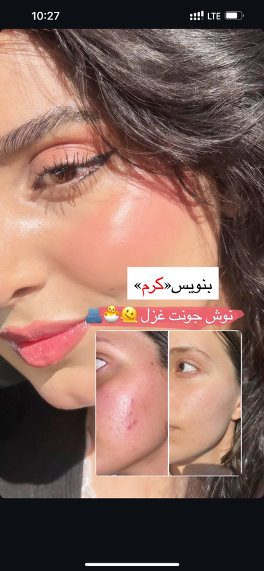 پك روشن كننده وضدلك بيوممتيك ايتاليايي