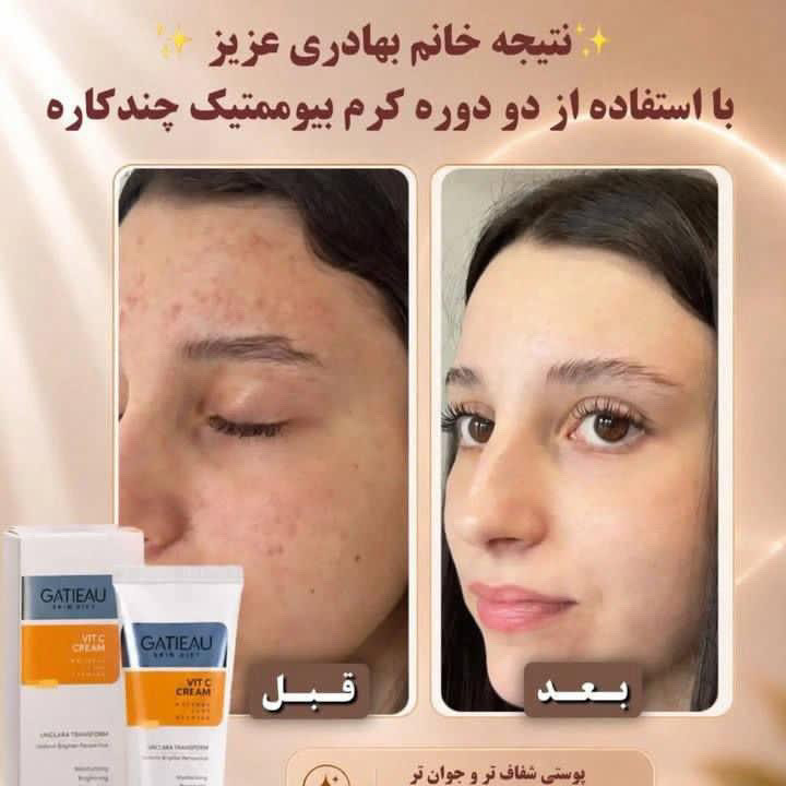 كرم روشن كننده وضدلك بيوممتيك پوست ابدار وهلويي ميكنه