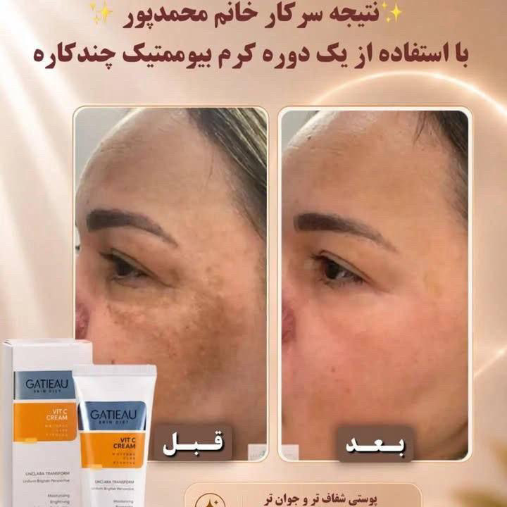 كرم روشن كننده وضدلك بيوممتيك پوست ابدار وهلويي ميكنه