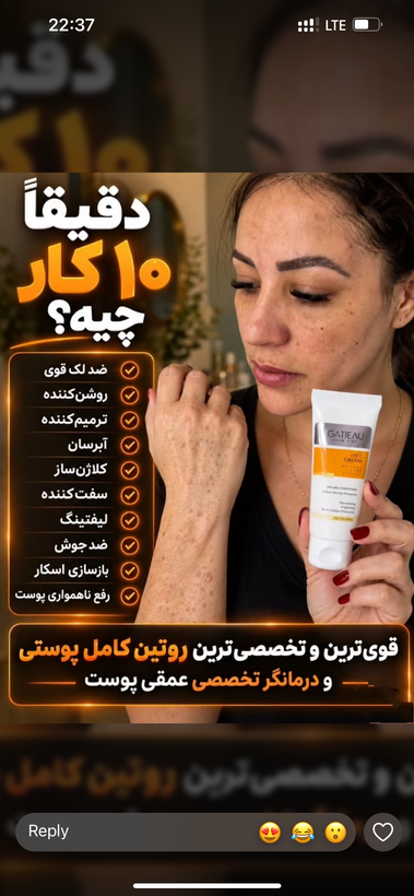 كرم روشن كننده وضدلك بيوممتيك پوست ابدار وهلويي ميكنه
