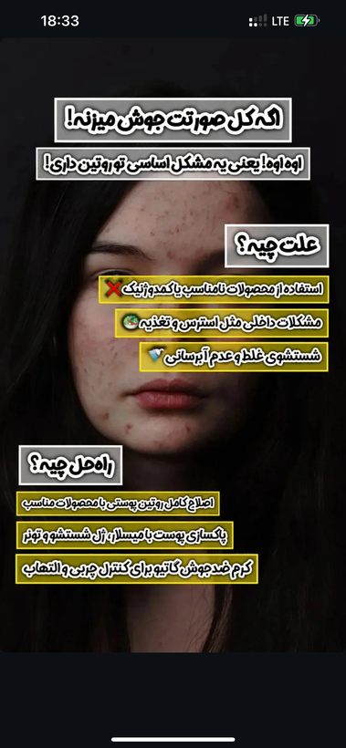 کرم ضدجوش بیوممتیک معجزه قرن