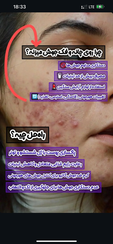 کرم ضدجوش بیوممتیک معجزه قرن