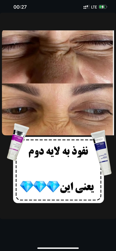 كرم بوتاكس گاتيو بيوممتيك اصل داراي باركد جايگزين بوتاكس و روشهاي تهاجمي